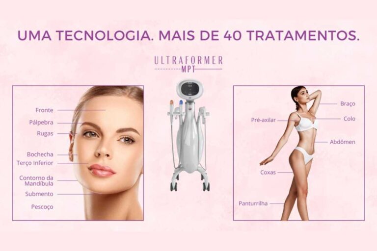 Vantagens da locação do Ultraformer MPT: investimento inteligente para clínicas de estética